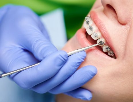 Invisalign vs Traditional Braces: Which is Right for You?
