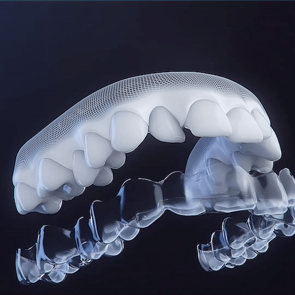 Invisalign Aligner Movement GIF
