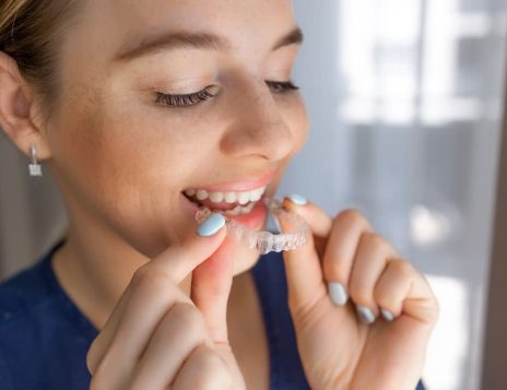 Straighten Your Teeth Comfortably with Invisalign in Beckenham
