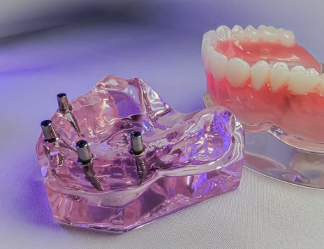 How Gum Disease Affects Dental Implant Treatment