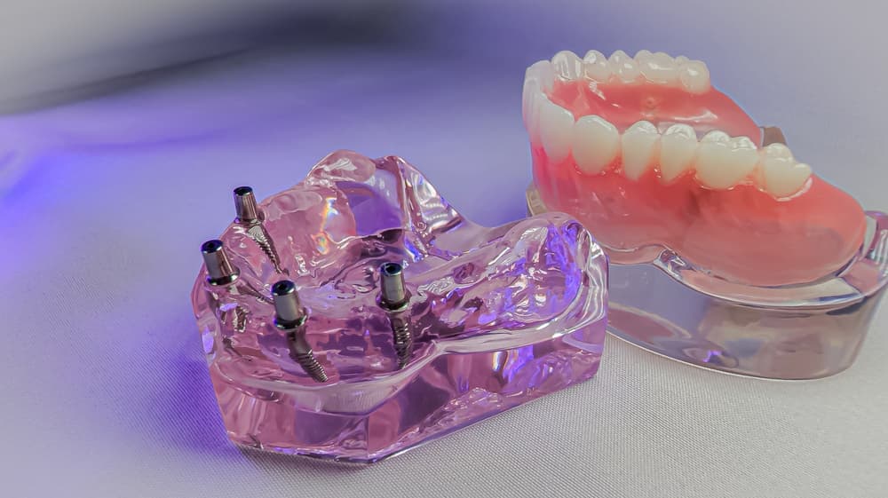 dental bone graft