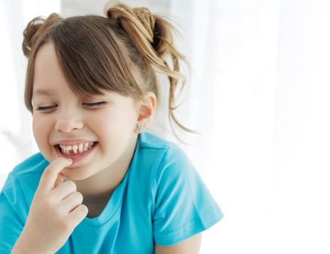 What Are Fissure Sealants and How Do They Protect