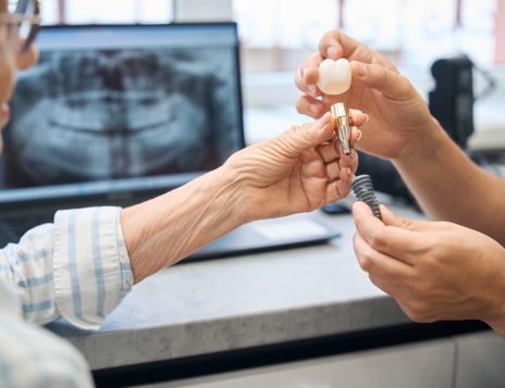 Managing Swelling After Dental Implant Surgery